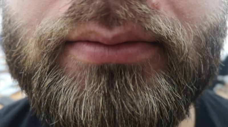 Ako nosite bradu, moguće je da imate više bakterija nego pas