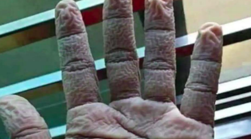 Fotografija smežurane ruke zadivila svijet: ”Blagoslovljene bile te ruke”