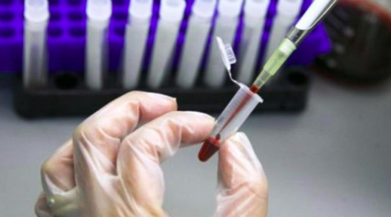 Farmaceutske tvrtke ne vjeruju da će biti jedinstvenog lijeka za covid-19
