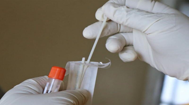 Kuprešaci više ne moraju na testiranje u Livno ili Tomislavgrad