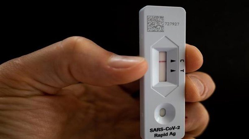 Koliko su pouzdani brzi antigenski testovi?
